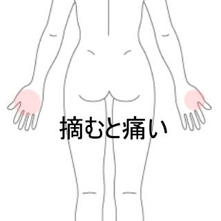 手指の痛み