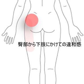 臀部痛