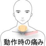 鎖骨の痛み