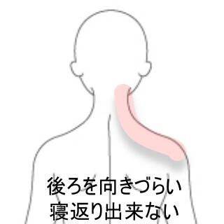 kubi