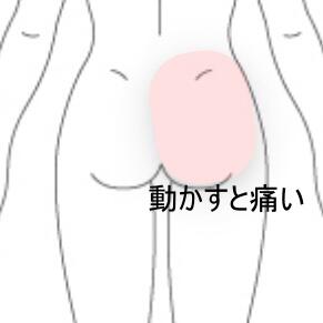 腰痛