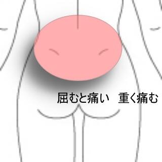 腰痛1