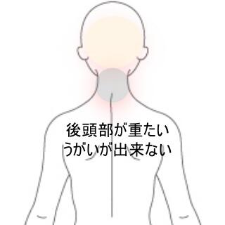 頭痛
