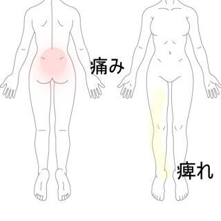 脚の痺れ