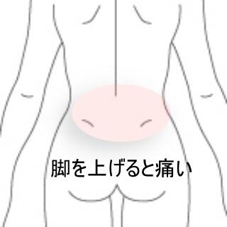 腰痛