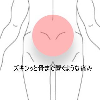 腰痛