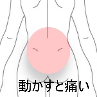 ギックリ腰