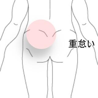 腰臀部痛