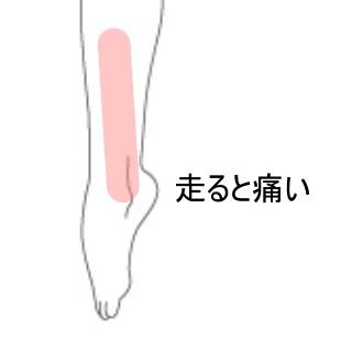 シンスプリント