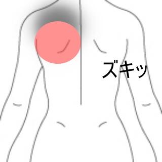 背部痛 1