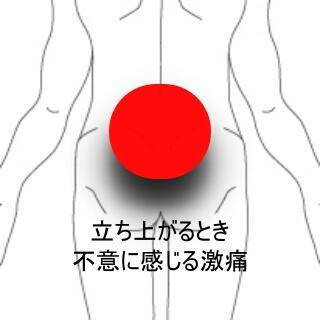 腰痛