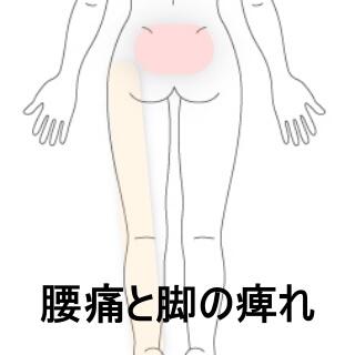 腰痛と脚の痺れ