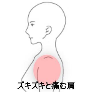 肩の痛み