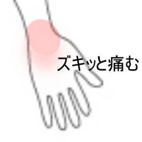 手関節の痛み
