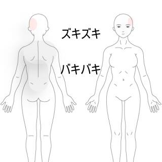 側頭部痛