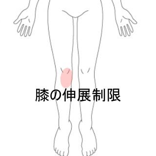 膝の痛み