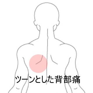 背部痛