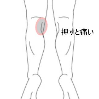 膝の内側の痛み
