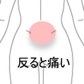 反ると痛い腰