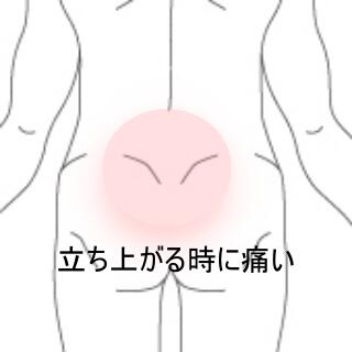腰痛