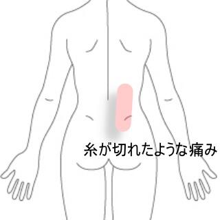 ぎっくり腰