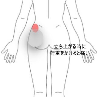 股関節