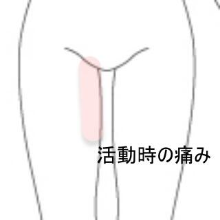 内転筋の痛み