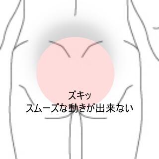 腰痛