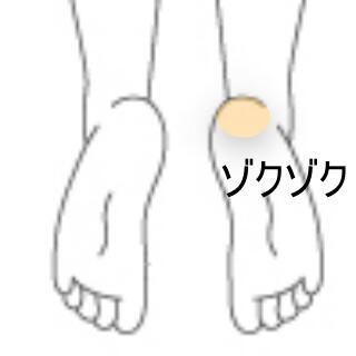 踵の違和感