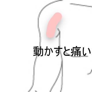 腕の痛み