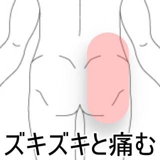 臀部痛