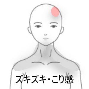 頭痛