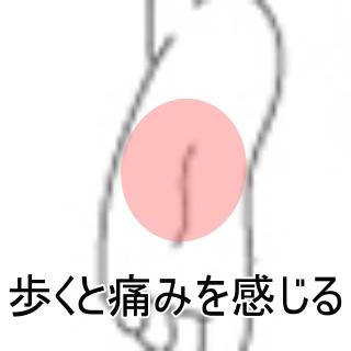 歩くと足裏痛い