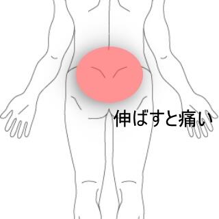 腰痛
