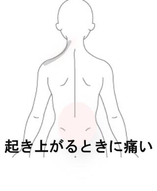 起き上がり時痛い