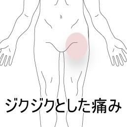 股関節の痛み