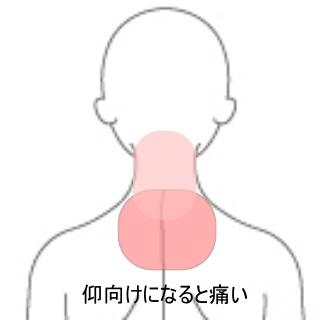 頸部痛