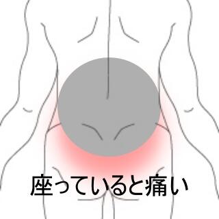 腰痛