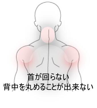 背中の痛み