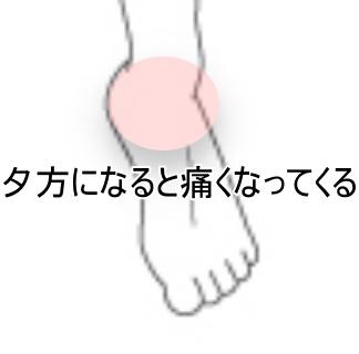 足首の痛み