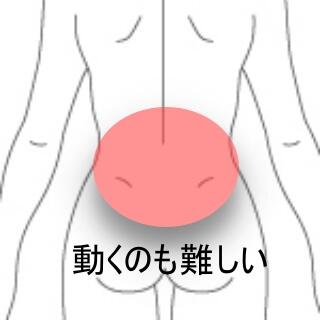 ギックリ腰