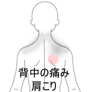 背中の痛み