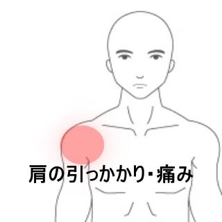 肩の痛み