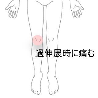 過伸展時に膝の痛み