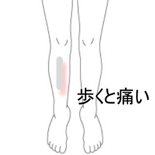 脛の痛み