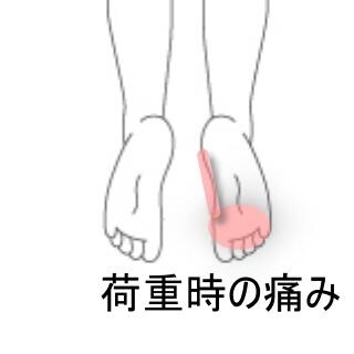 足裏の痛み