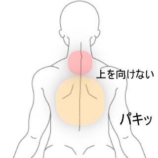 頚背部痛