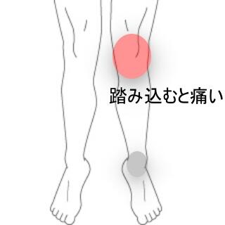 膝痛