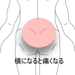 腰痛