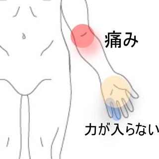 肘の痛み